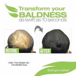 Suriz BioExpress Hair